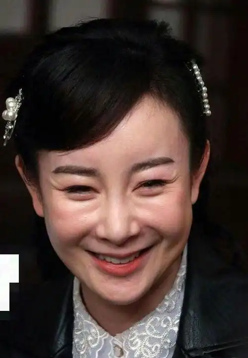 而她的整容的后遗症也逐渐明显,她的脸逐渐垮了,演戏时也失去了一颦