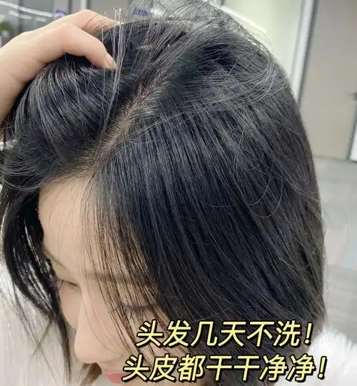 去屑又养头皮的洗发水推荐_头发_问题_成分