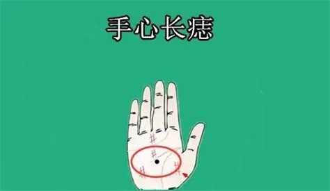 【女人右手掌心有痣图解】1,女人右手掌心有痣主富贵女人手掌中心有痣