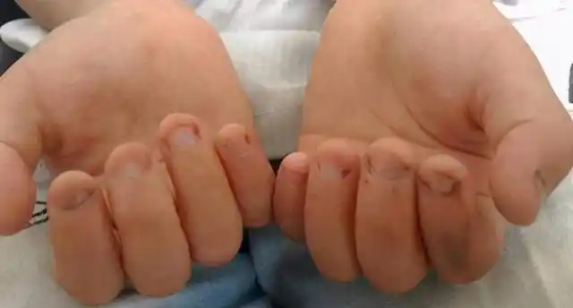 宝宝喜欢"咬指甲"?长大后大多难逃这几种结局,宝妈要趁早纠正