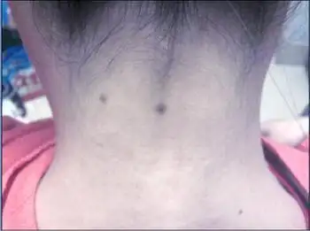 有苦情痣的人,是非常吉利的