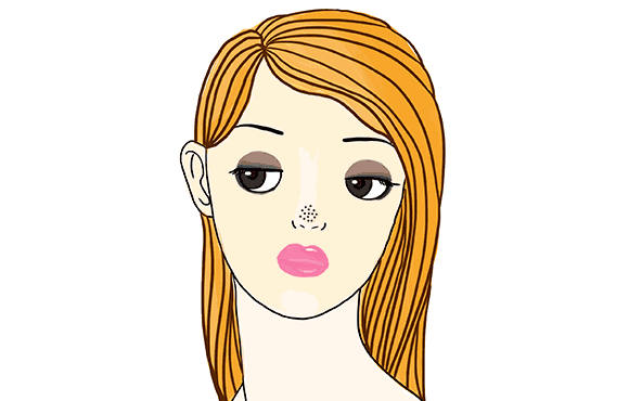 造成毛孔粗大的原因你知道吗?