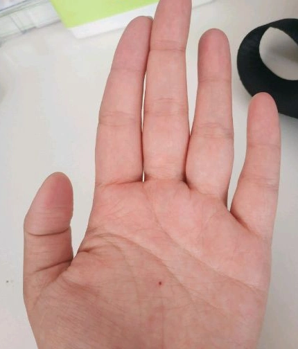 左手朱砂痣手相好不好朱砂痣命运解析