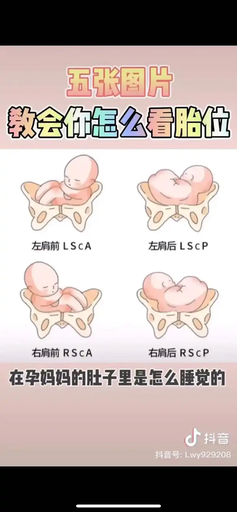 五张图片教会你怎么看胎位左肩前lsca左肩后lscp右肩前r - 抖音