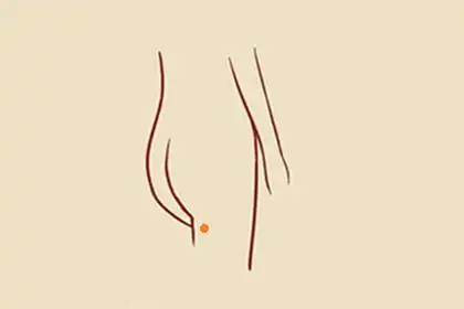 大腿根有痣的女人代表什么生活幸福美满