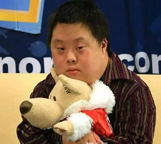 先天愚型宝宝笑的图片