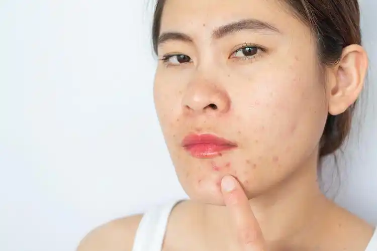 不同原因造成的皮肤敏感该如何处理? - 知乎