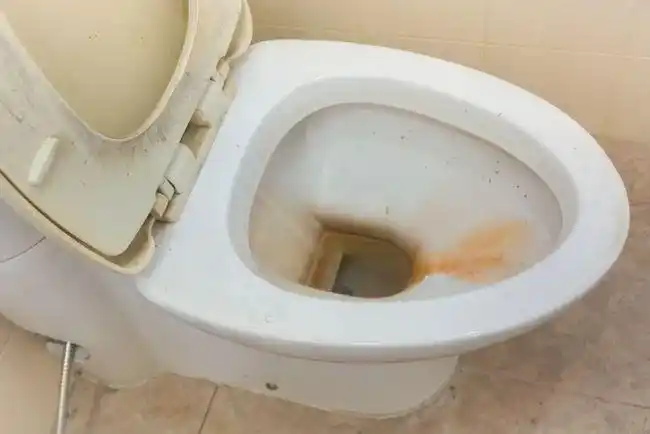 即便有,大多数人也不愿碰那个可能被无数"小脏手"污染过的马桶盖