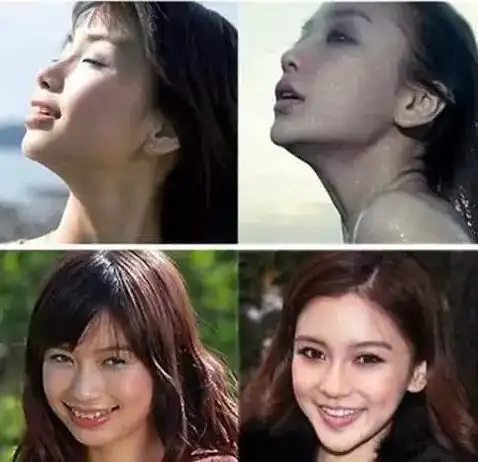 angelababy整容了吗angelababy整容前后对比