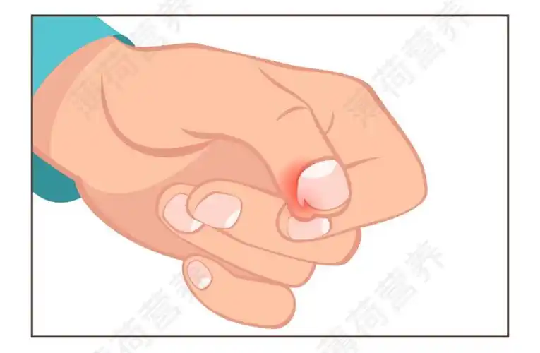 为什么成年人会啃指甲上瘾