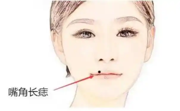 身上手上有这几颗痣 多遇贵人 抓准时机 实现一夜暴富