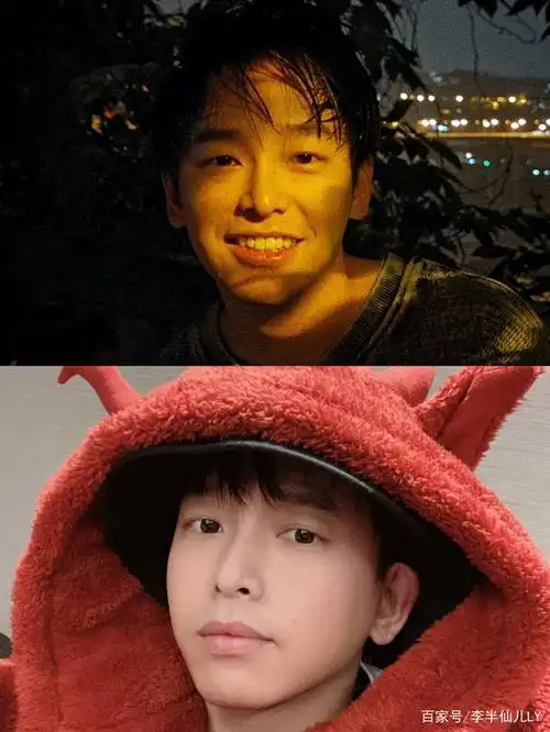 因为彭昱畅的发际线很高,额头露出比较多,额头比较宽.