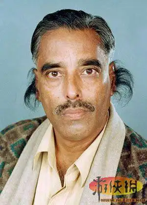 震惊世界的人体之最 眼球突出眼眶外11毫米