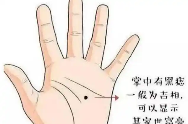 掌中有黑痣的人命好掌中有黑痣的人一般理财能力强,即使年轻时因为