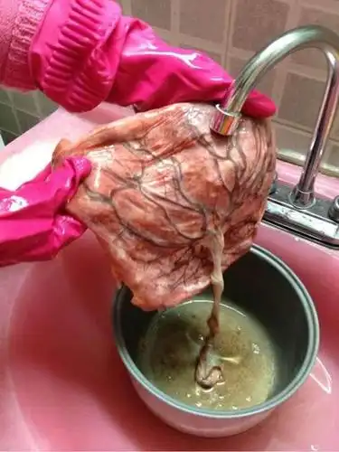 供应新鲜健康冷冻胎盘长期销售顺丰冷链包邮