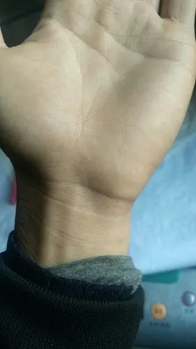左手生命线有岛纹,还很大打师帮我看看