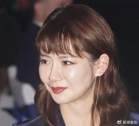 戚薇近照曝光颜值崩塌面容变形疑似医美后遗症