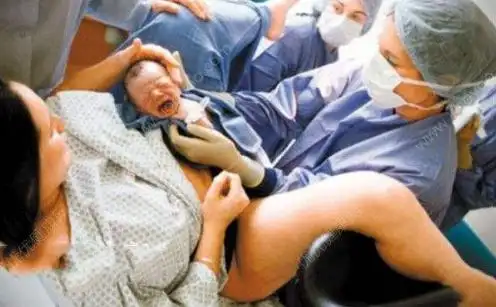 剖腹产比顺产疼别逗了其实顺产没你想象中的那么好