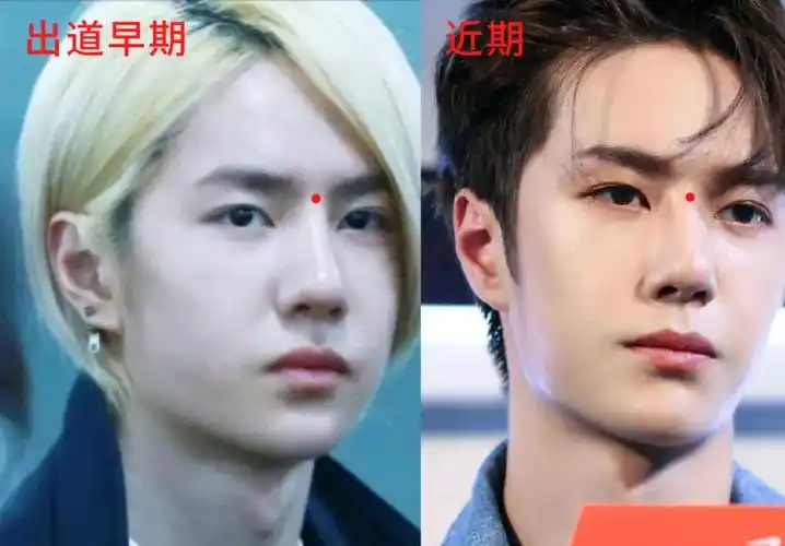 王一博的鼻子假在哪里?