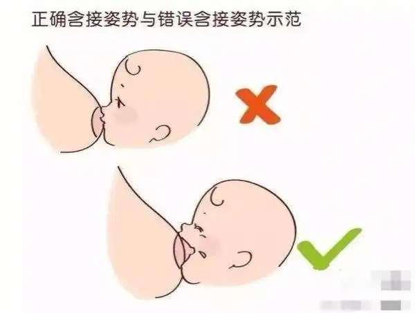 "喂奶的疼超过生孩子的疼"这话你认同吗?09乳头疼,那是真疼!