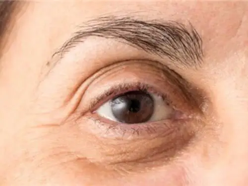 眼部护理# 眼部和身体其他部位相比有哪些特点?
