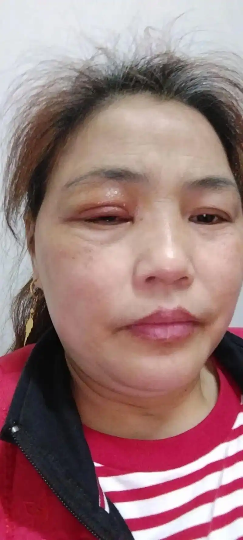 好可怜的我呀,这几天眼睛上火,眼睛都肿了,可怜兮兮的呀,整天 - 抖音