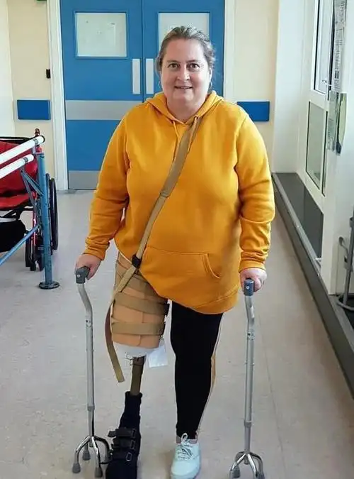 女子摔一跤腿疼10年恳求医生为她截肢截完称生活质量提升了