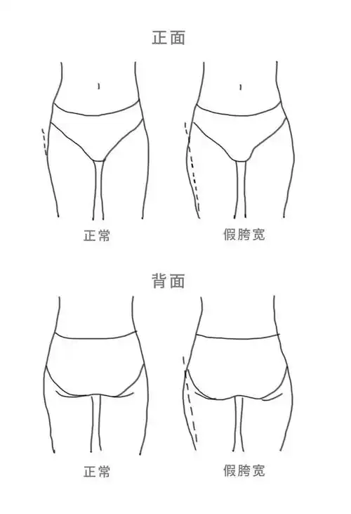造成了大腿根是"胯的错误视觉",所以,假胯宽,宽的是大腿.▼