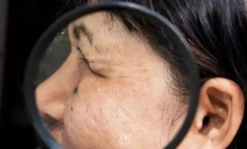 皮肤差,脸色差,一脸萎靡的样子.如果你也是这样,就该好好休息了