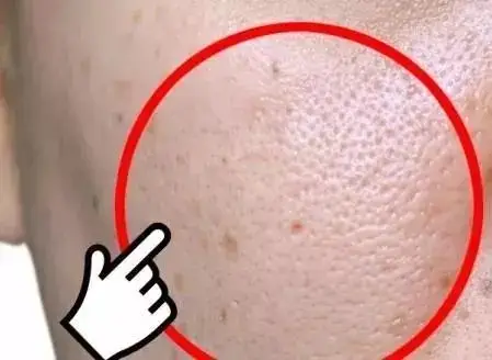 洗出细腻毛孔,跟黑头角质说拜拜.