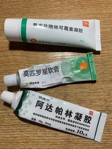 额头经常有闭口鼻子黑头很多脸颊毛孔粗大怎么开始护肤