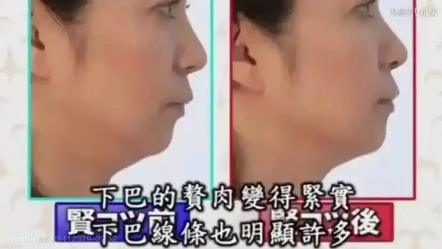 刘亦菲最新照片网友吓人这下巴是认真的吗