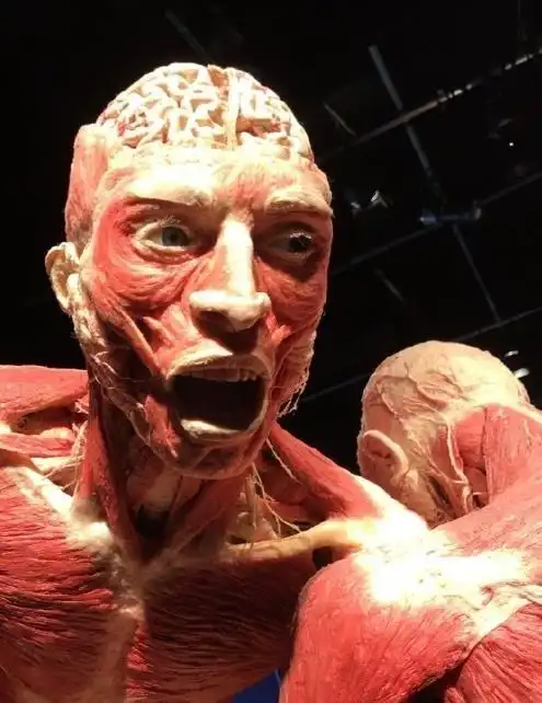 用真人捐献的遗体制作的人体标本