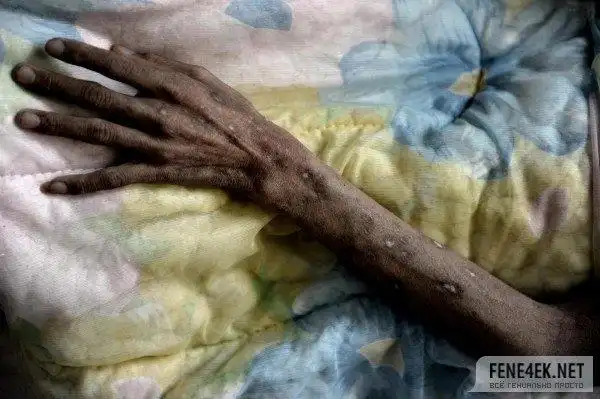 近年来, 泰国的爱滋病患者有越来越年轻化的趋势,青少年感染爱滋病的