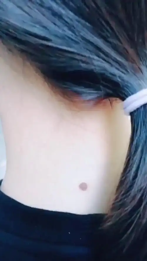 但是一般女人脖子后面的痣称为苦情        展开全文 c