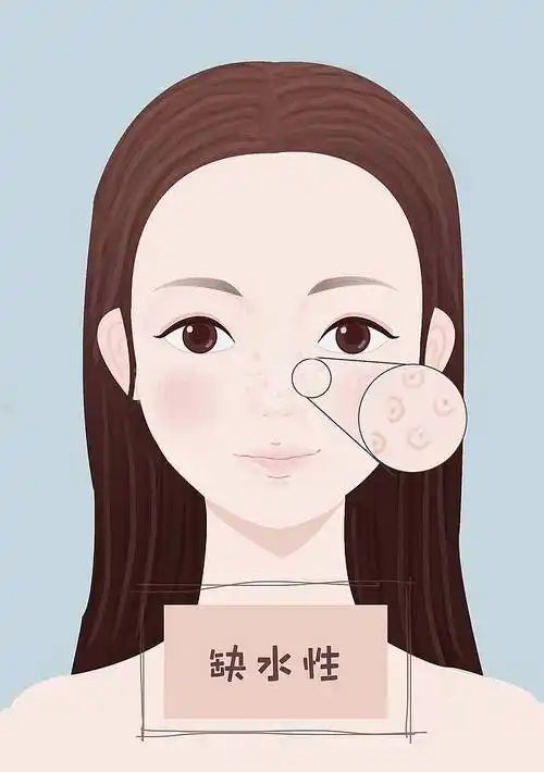 毛孔粗大角质性毛孔粗大缺水性毛孔粗大老化性毛孔粗大医美光子嫩肤