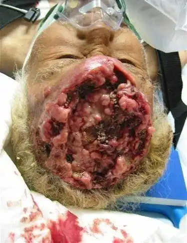 日本人吃寿司吃到脑袋起蛆~鄙视它们(恶心图片)