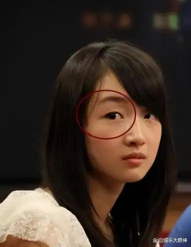 事实证明"双眼皮不能乱割",从戚薇到景甜,"后遗症"都出现了