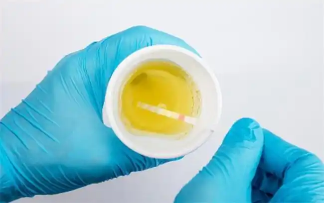 蛋白尿吃什么药好得快-排行榜大全