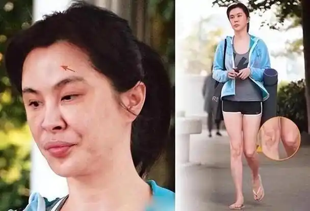 回顾:以为她们是退圈了,原来是整容后"面目全非"没认出来