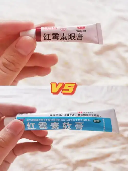 湿疹宝宝抗生素药膏