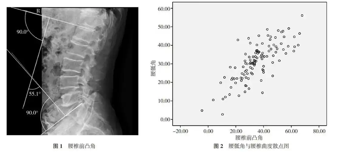 腰骶角和腰椎曲度的相关性研究