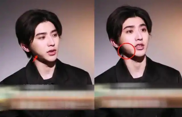 蔡徐坤大变脸体型发胖发型奇特曾万人追捧的小鲜肉秒变蛇精脸