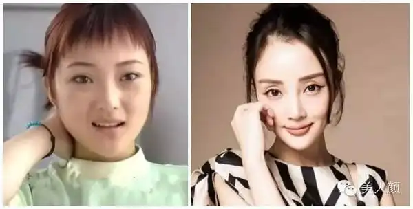 李小璐亮相芭莎慈善夜,再遭整容质疑