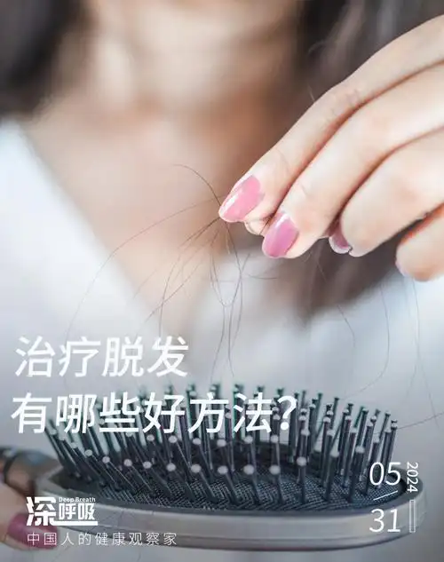 5种"脱发治疗方式"大pk,哪一种省钱又有效?