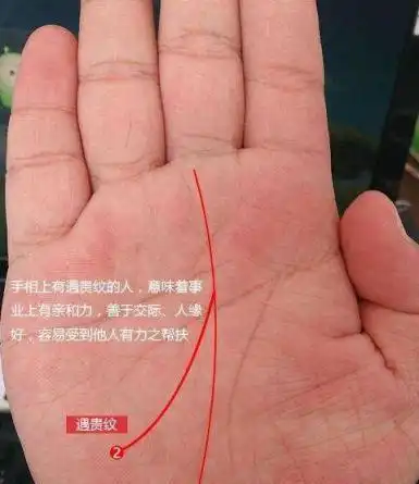 3,黑子纹的富婆手相:这位富婆的手心明堂边缘有一黑子纹,说明此人具有