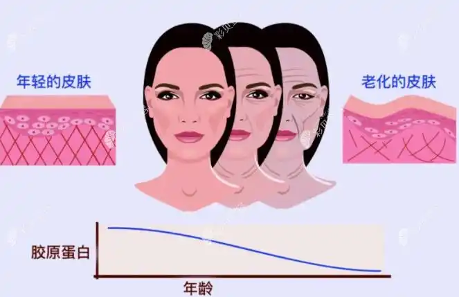 年轻皮肤和老化皮肤胶原蛋白量对比图