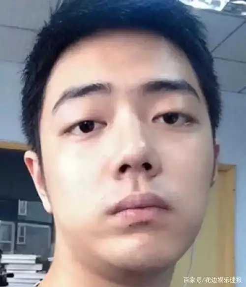 肖战成名前与现在差很大,到底整没整容有图为证