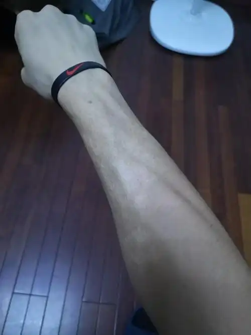 胳膊上有烫疤可以报考警校吗?