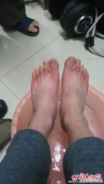 男子雪地裸奔脚被冻伤网友调侃咋没给脑子冻伤